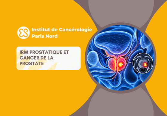 IRM prostatique et cancer de la prostate