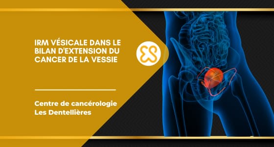 IRM Vésicale dans le cancer de la vessie