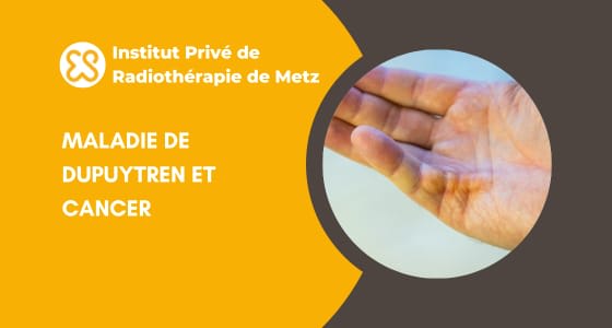 Maladie de Dupuytren et cancer