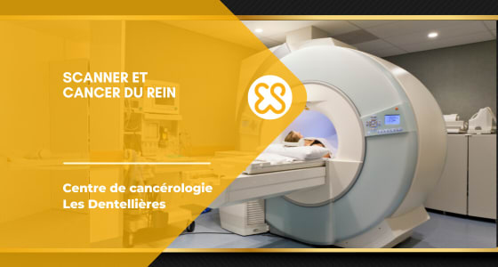 Scanner et cancer du rein