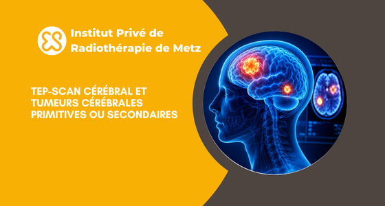 TEP-scan cérébral et tumeurs cérébrales primitives ou secondaires