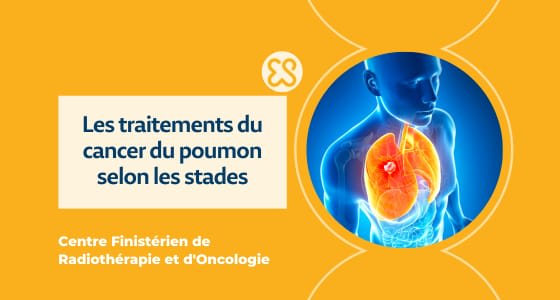 Les traitements du cancer du poumon selon les stades
