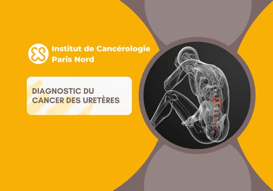 Diagnostic du cancer des uretères