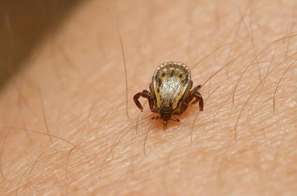 typhus