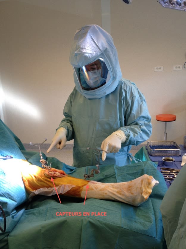 Dr PERLINSKI, arthrose du genou