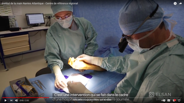 VIDEO DUPUYTREN