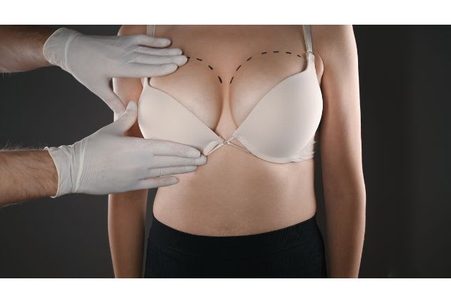 Augmentation mammaire