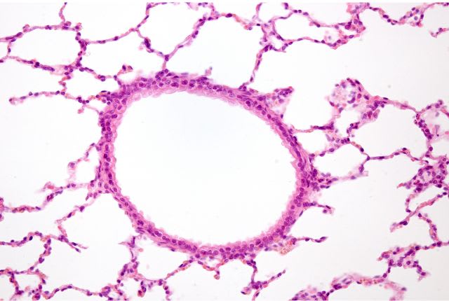 Bronchiolite