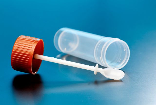 Coproculture : reproduction d'un tube d'analyse de selles.