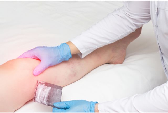 Gonarthrose