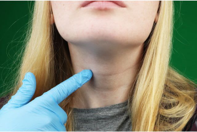 Hypothyroïdie