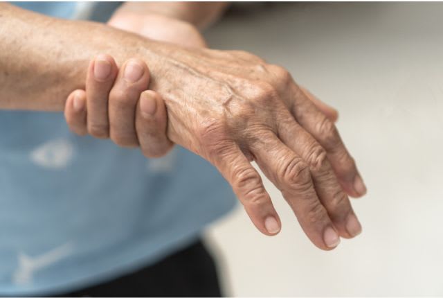 Neuropathie périphérique : une patiente se tient le poignet douloureux.