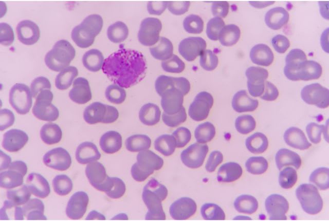 Polynucléaires basophiles