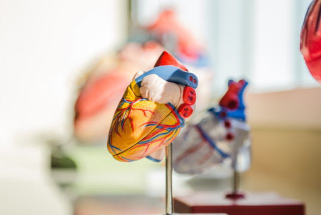 Amylose cardiaque : maquette d'un cœur.