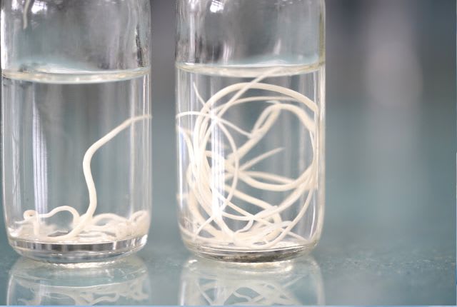 Vers intestinaux ronds Ascaris dans des verres remplis de solution. Ils provoquent l'ascaridiose.