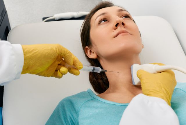 Comment detecter un cancer ? Biopsie de la glande thyroïde : aspiration avec une fine aiguille au niveau du cou d'une jeune-femme.