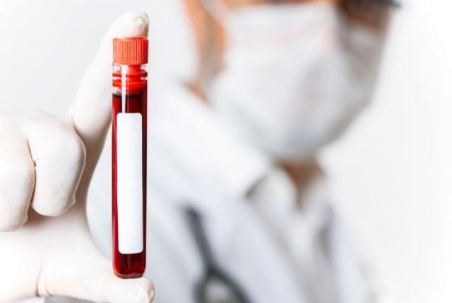 Prélèvement sanguin en laboratoire pour l’analyse du bilan lipidique et le dépistage des dyslipidémies.