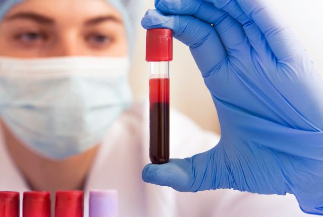 Un soignant montre un tube de sang destiné à être analysé. Le dosage sanguin de la lipase constitue un outil fiable.