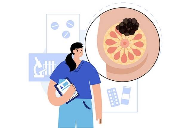 mastite causes et explications