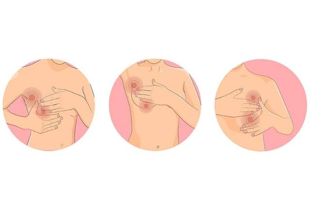 senologie examen