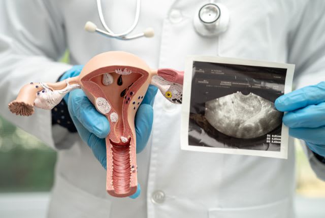 Utérus rétroversé : un soignant présente une maquette d'appareil génital féminin et une image d'échographie.