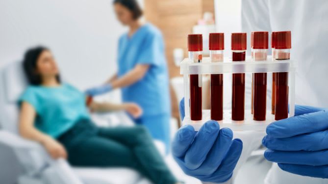 Les infections sexuellement transmissibles explosent en Europe selon un rapport de mars 2024 : gros plan sur des tubes de sang, en arrière plan, une femme est installée pour une prise de sang.