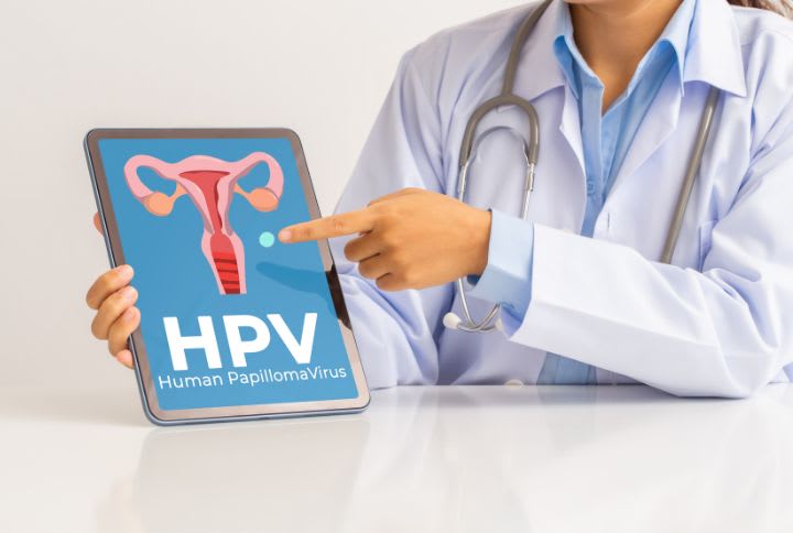 Dépistage papillomavirus : image d'un médecin montrant une pancarte sur le HPV ou papillomavirus