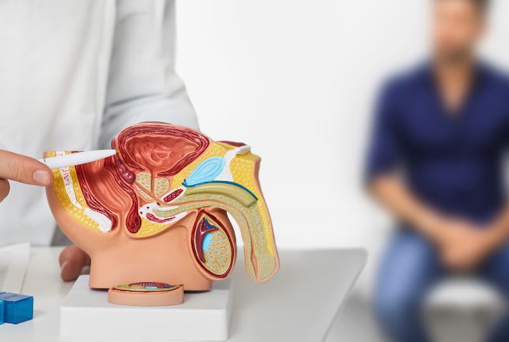 Dépistage du cancer de la prostate : un soignant montre à un patient l'appareil urinaire et reproducteur masculin sur un modèle.