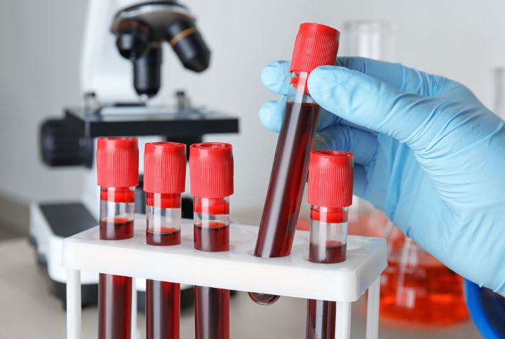 Protéine C réactive ou CRP. Image d'une main gantée tenant un tube de sang de laboratoire.