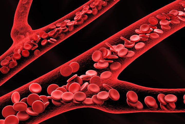 Syndromes myéloprolifératifs. Illustration en 3D des globules rouges dans les veines.
