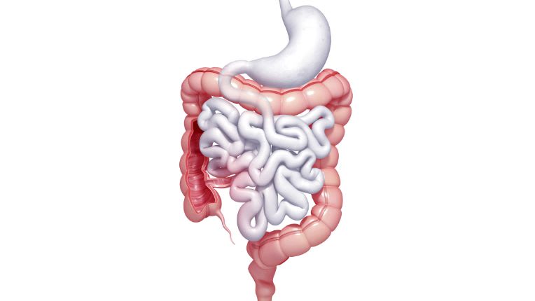 Opération de l'intestin grêle par robot à Brest. Image de synthèse reproduisant le système digestif avec, en haut, l'œsophage, l'estomac, l'intestin grêle, le gros intestin ou côlon, le rectum et l'anus. 