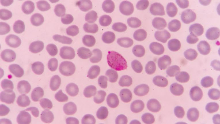Image au microscope du parasite plasmodium, cause du paludisme.