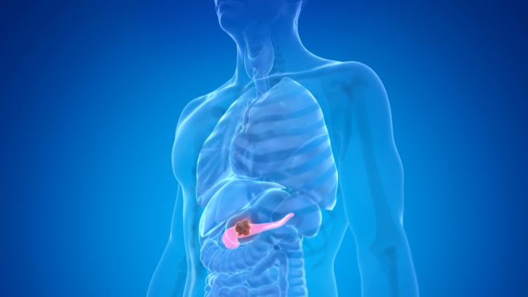 Pancréatite : image de synthèse d'un corps humain figurant le pancréas dans l'abdomen. Un point signale l'inflammation de cette glande.