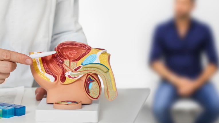 Prostatectomie : un soignant donne des explications à un patient en utilisant un modèle reproduisant l'appareil génital masculin.