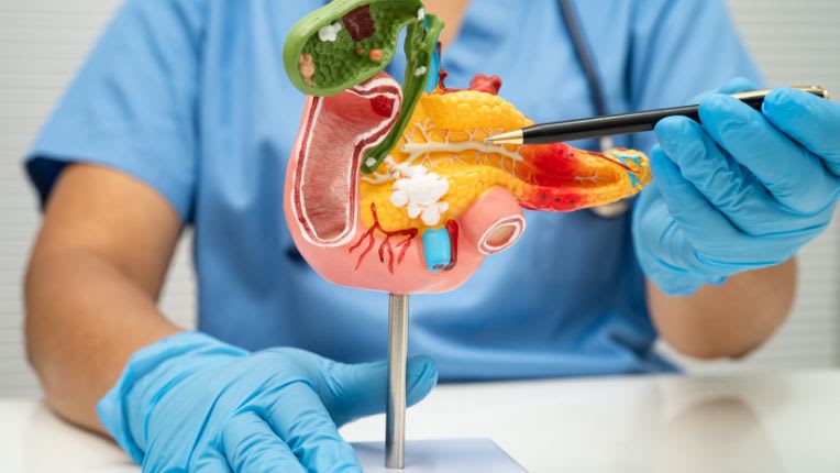 Cancer du pancréas : le daraxonrasib améliore la survie des patients. Un soignant montre pointe avec son stylo vers une maquette de pancréas.