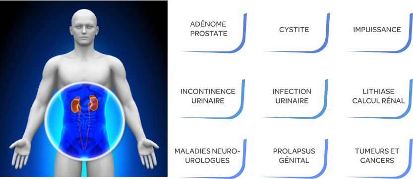 urologie