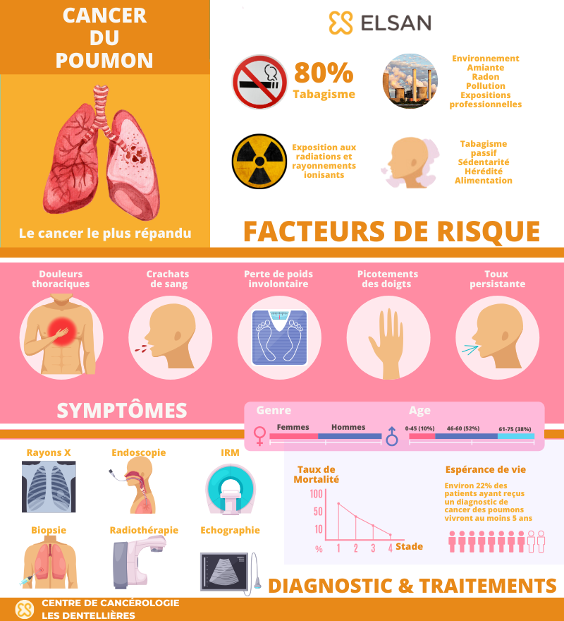 Infographie - cancer du poumon - Elsan les Dentellières