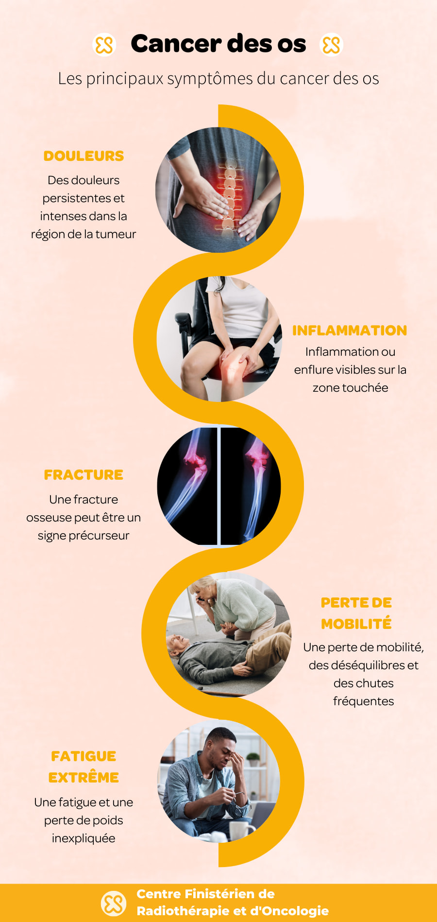 les symptômes du cancer des os