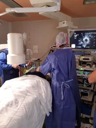 appareil pour L’Echo-endoscopie, photo montrant comment se déroule une  Echo-endoscopie