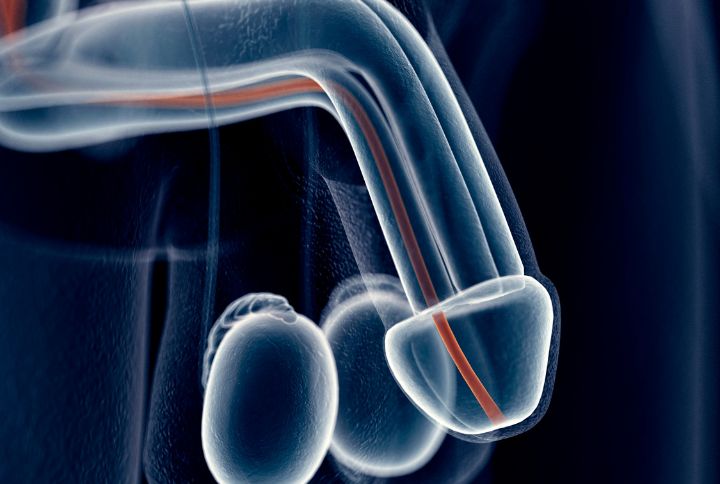 Cancer du pénis ou de la verge : définition, symptômes, traitement. Image de synthèse figurant en 3 D le pénis et l'organe génital masculin.