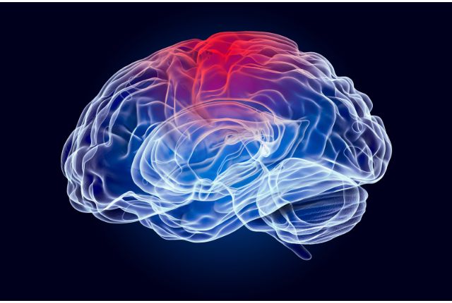 Commotion cérébrale