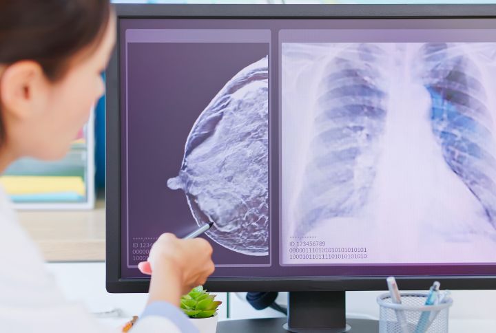 Dépistage cancer du sein : photo d'une radiologue examinant les clichés d'une mammographie