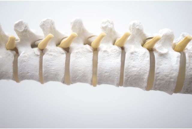 Discopathie : image de la colonne vertébrale et des disques intervertébraux.