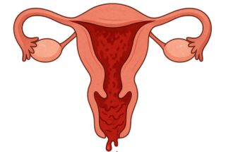 Illustration utérus en période re règle