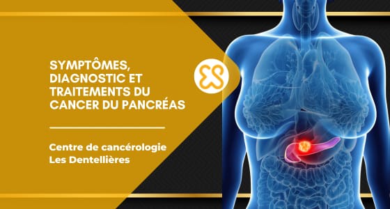 Cancer du pancréas, symptomes, diagnostic et traitements