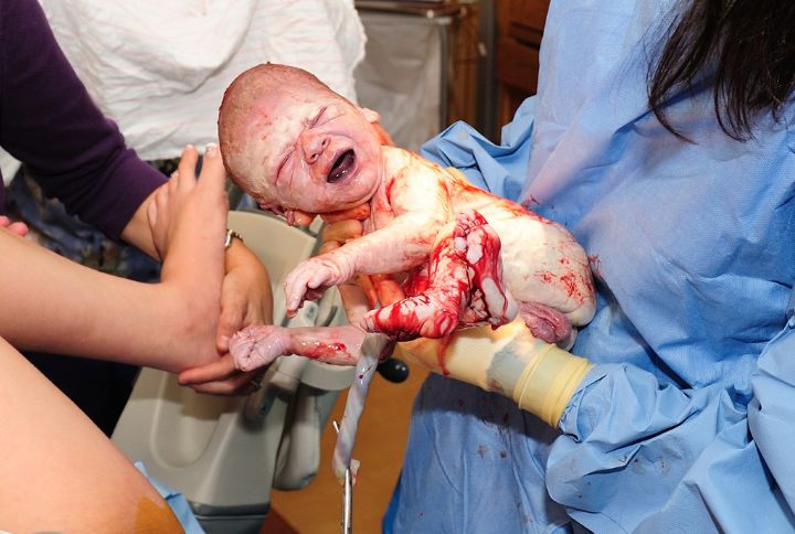 Accouchement par voie basse : image d'un nouveau-né juste après l'accouchement.