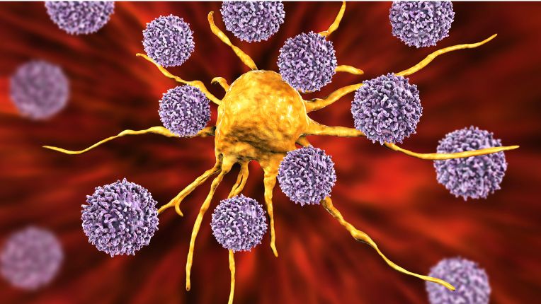 Qu'est-ce qu'un cancer ? Des cellules de l'immunité, lymphocytes, attaquent une cellule cancéreuse (image de synthèse).