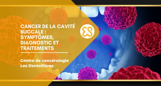 Cancer de la cavité buccale - Symptômes, diagnotcis et traitements