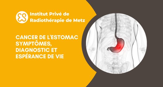 Cancer de l'estomac - Symptômes, diagnostic et espérance de vie