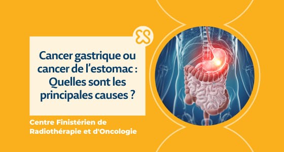 Cancer gastrique ou cancer de l'estomac, les principales causes